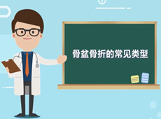 【醫(yī)療科普】骨盆骨折的常見(jiàn)類型有哪幾種？
